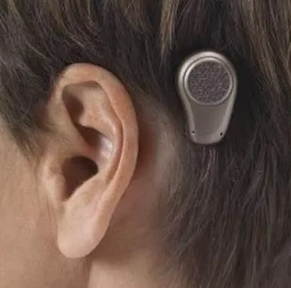 bn-803骨導式助聽器